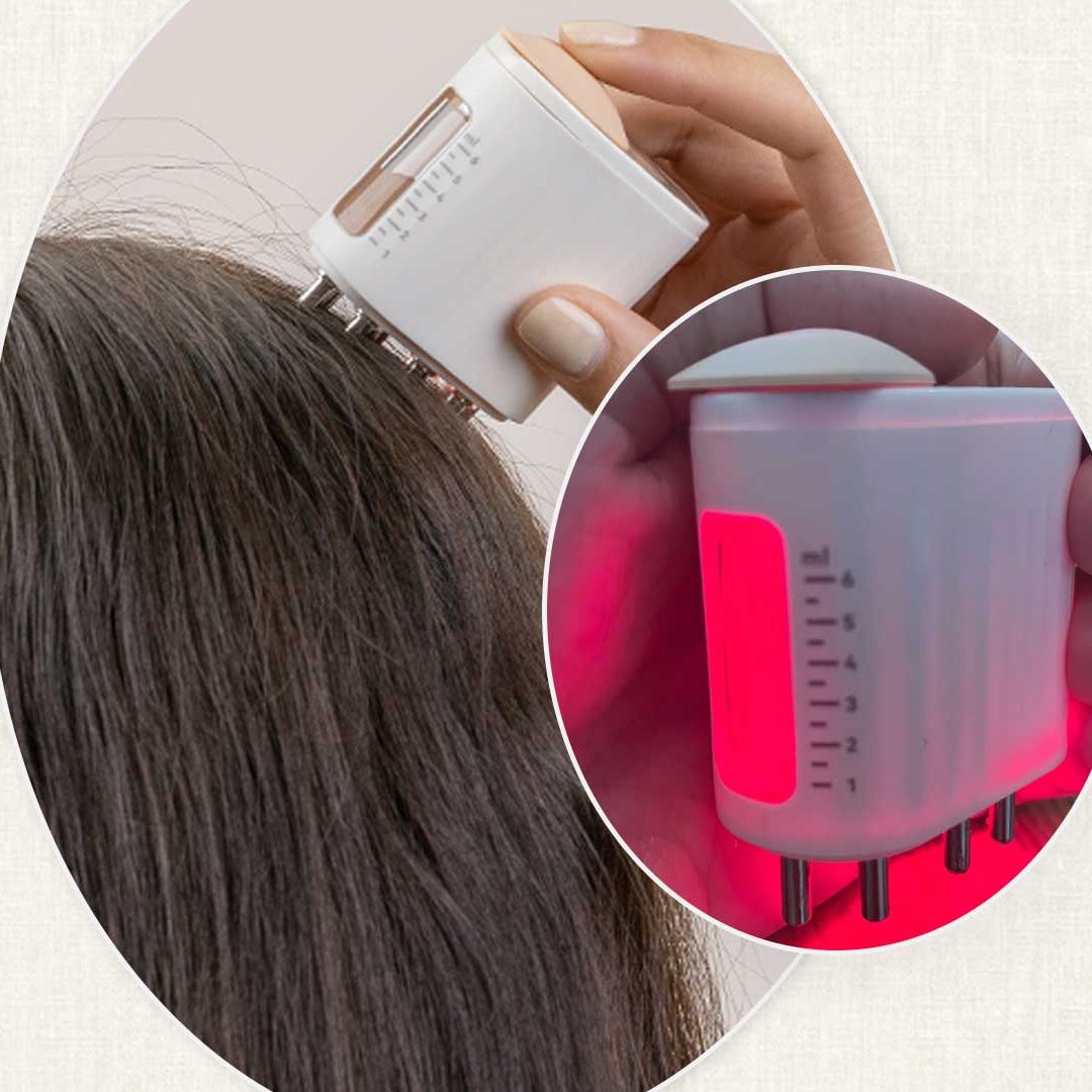 I'm 42 with thinning hair and credit this for slowing down hair loss